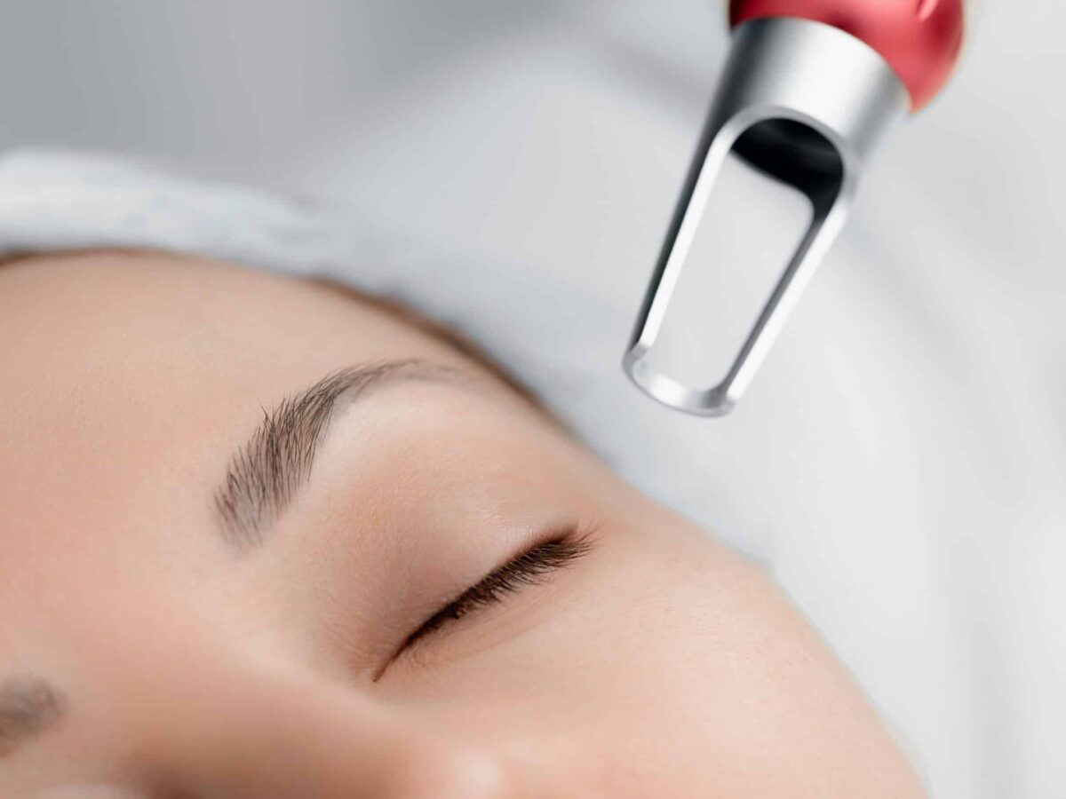 Side Effects of Pico Laser Treatments: What You Should Know