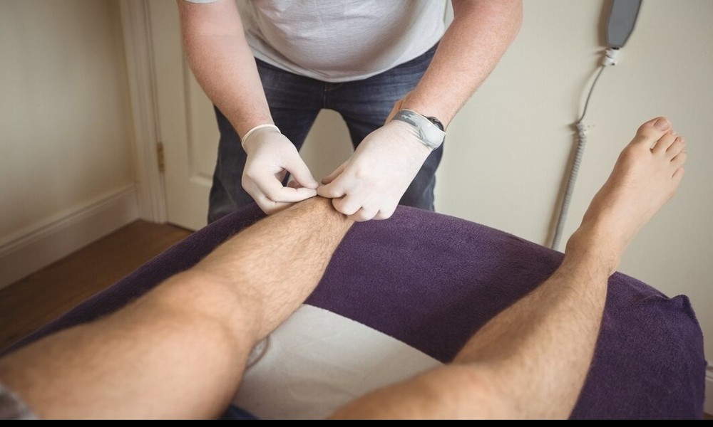 4 Signs You Need a Vascular Treatment