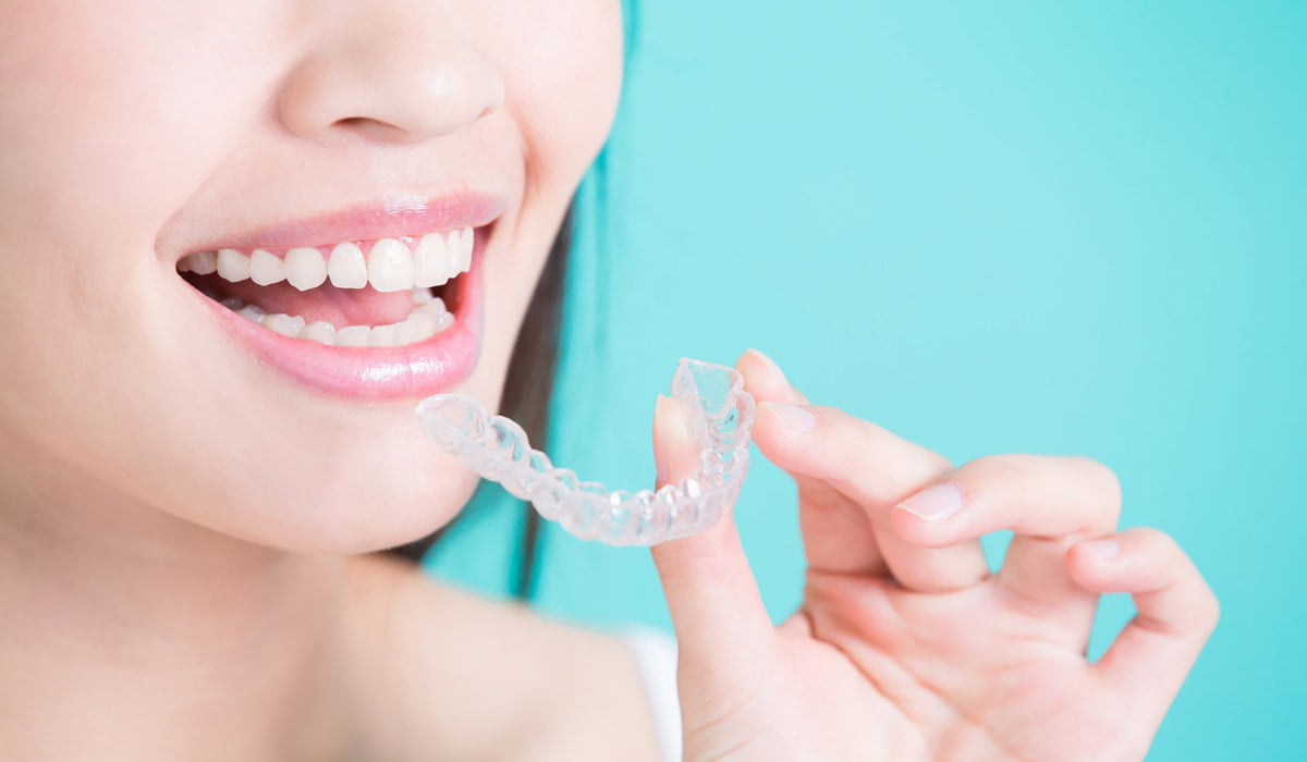 The procedure of Invisalign treatment