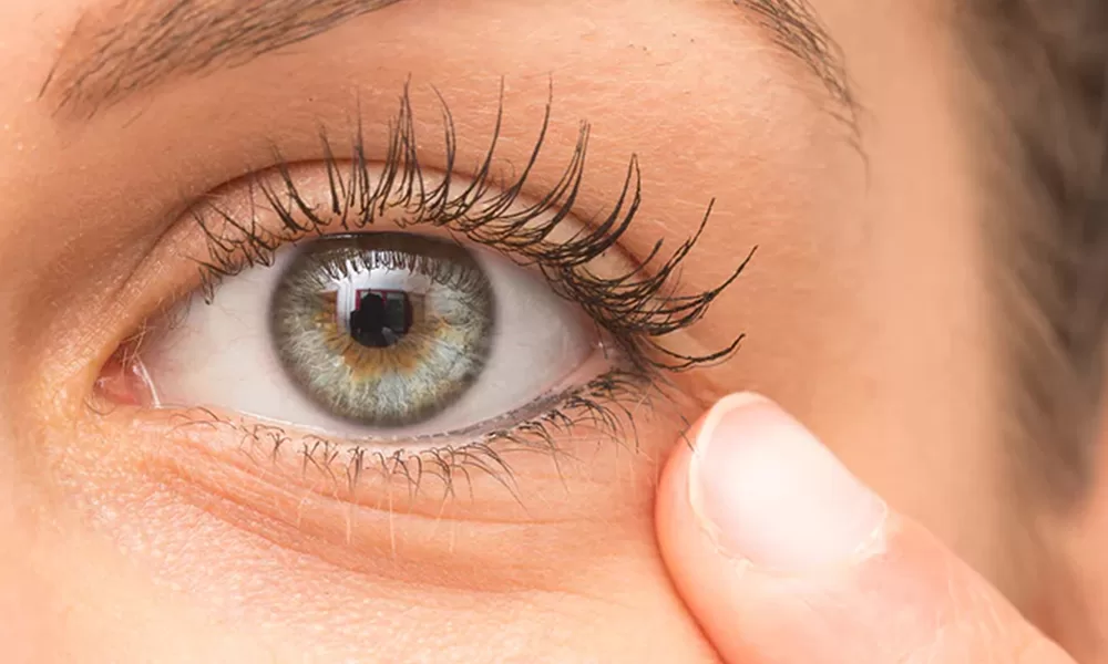 A Science-First Look at Under-Eye Puffiness