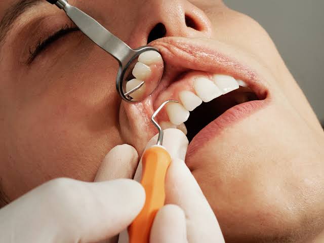 How to Choose the Best Dental Implant Provider Choose the Best Dental Implant Provider